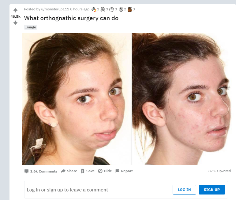 1605927935306.png