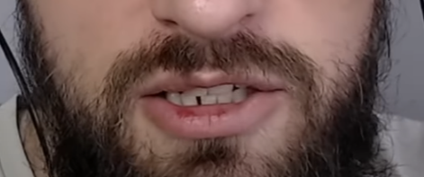 1675237690212.png