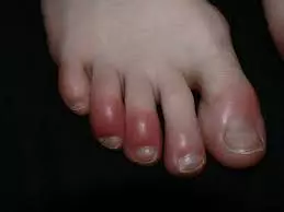 1751651923429.webp
