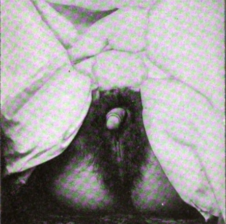 1903.png