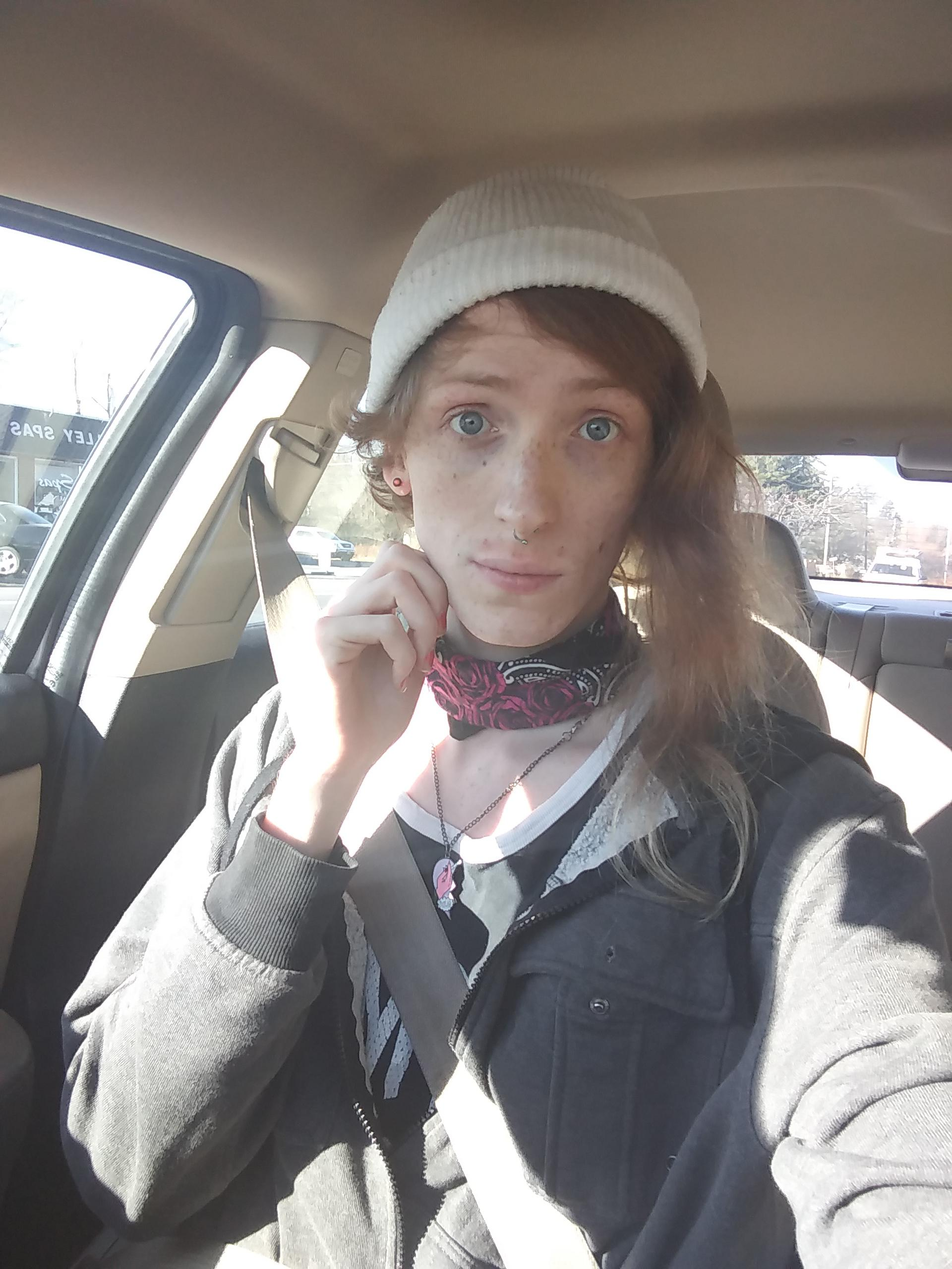 acne.png