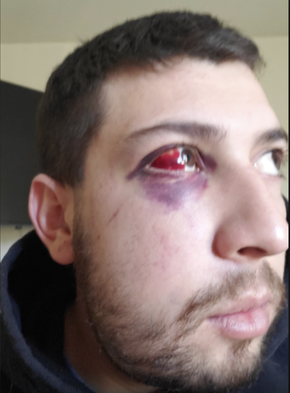 adly1kupdate.png