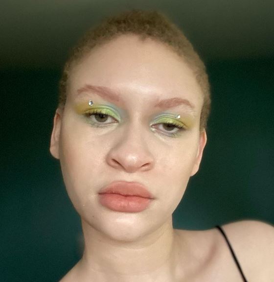 albinoboon.JPG