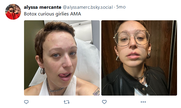alyssabotox.png