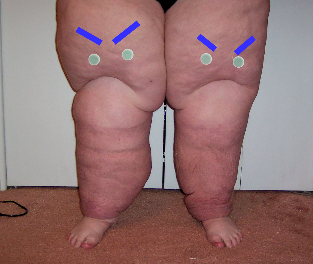 angry legs.png