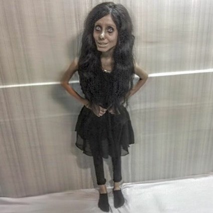 anorexia.jpg