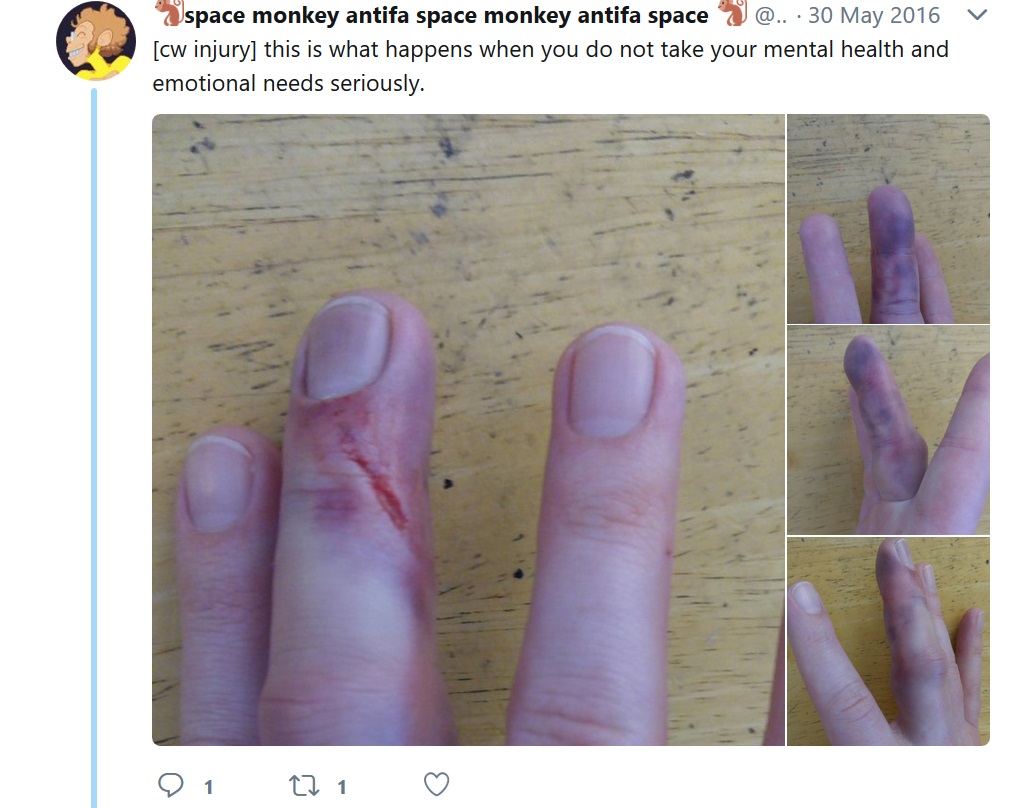 apeshitkerplunk3.jpg