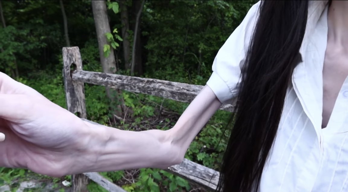 arm.jpg