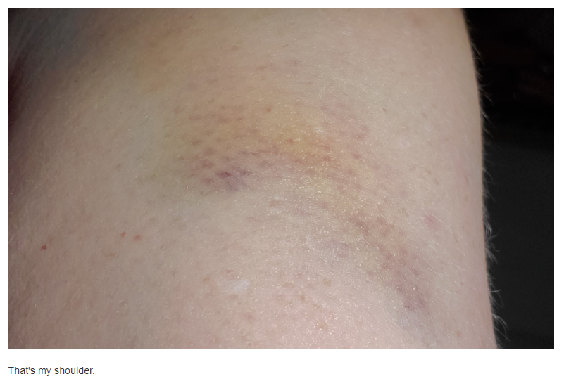 arm.PNG