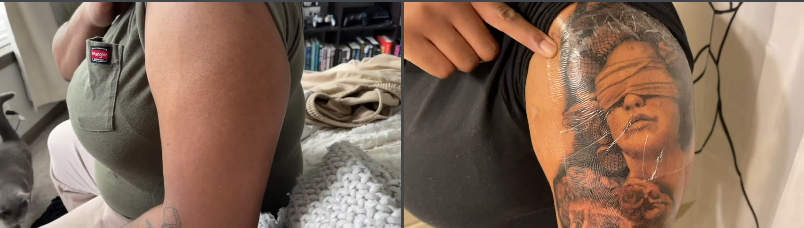 armbeforeafter.png