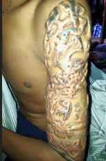 armsleeve.png