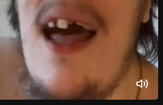 assanti teeth.PNG
