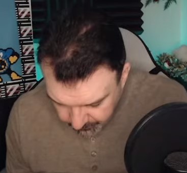 bald.jpg