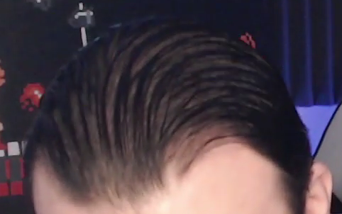 bald phil.png