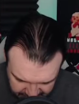 bald2.png