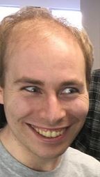 Balding.JPG