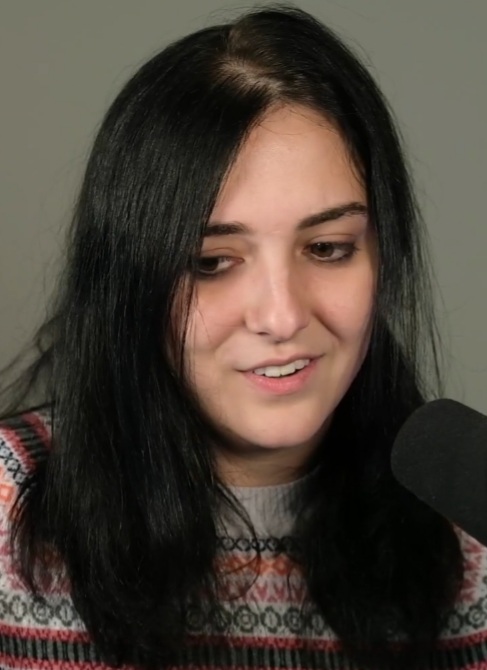 Balding2.jpg