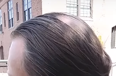 baldlucas.png