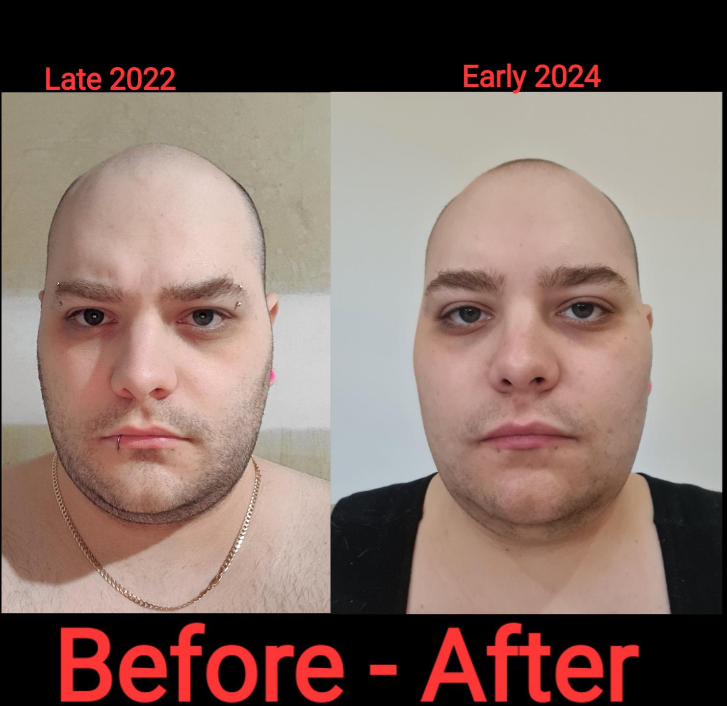 before_after.jpg