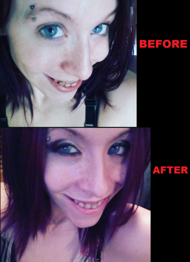 Before_And_After_Teeth.png