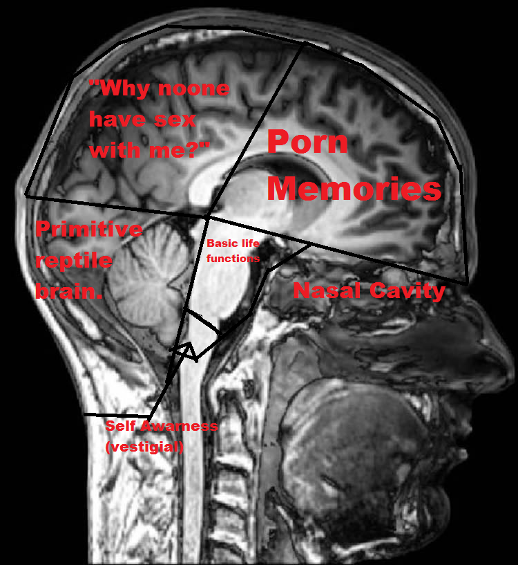 brainscan.png