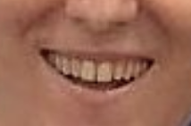British Smiles.png