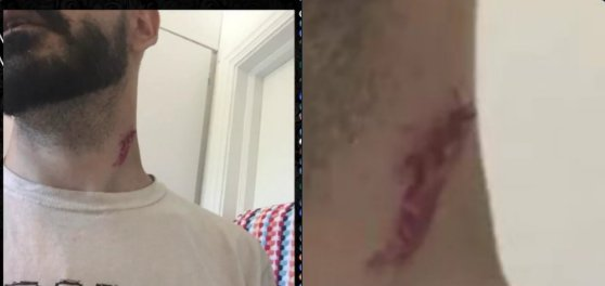 broskisurgery.png