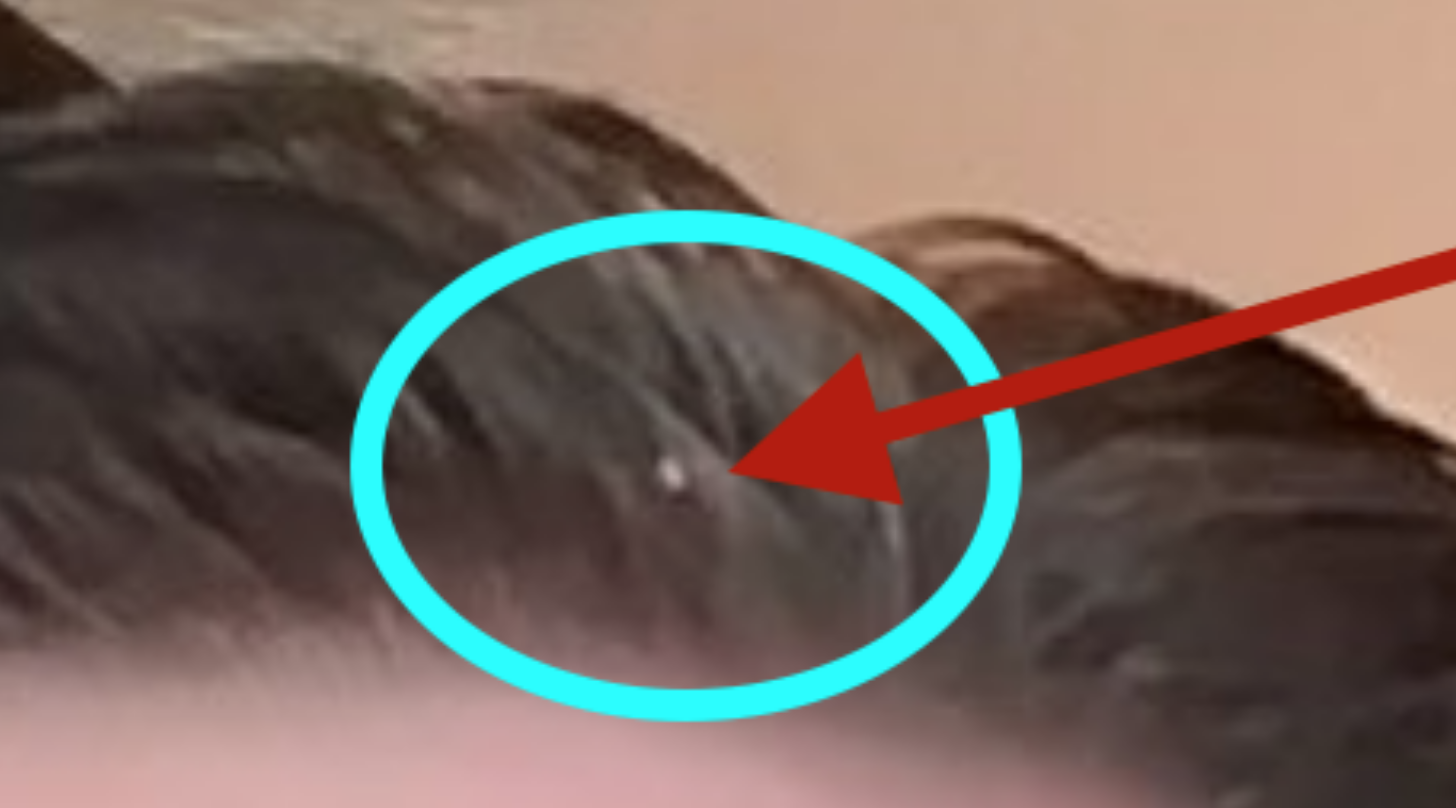 closeup.png