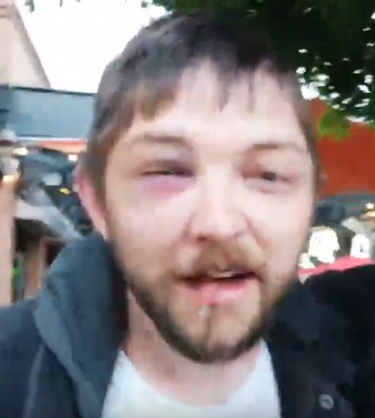 cNdPJxcK.png