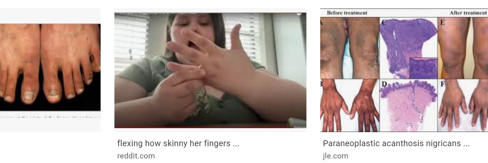 dark knuckles.JPG