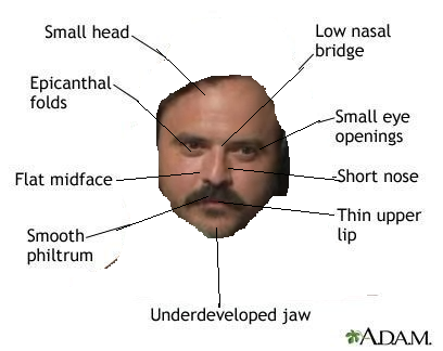 dickhead.png