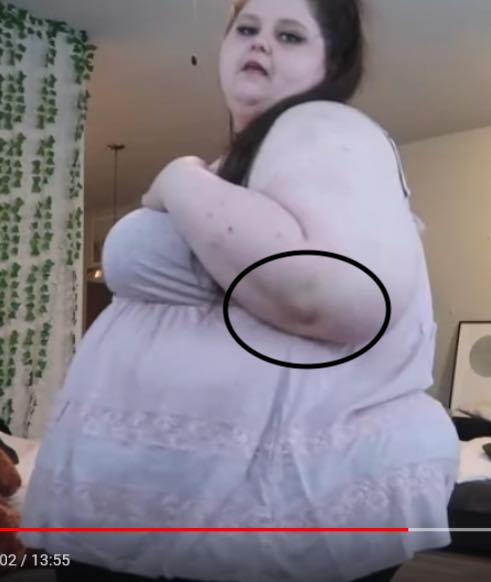 elbow.jpg