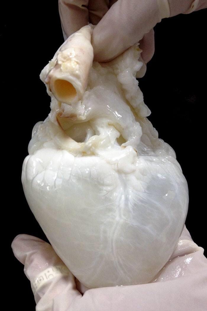 Empty Human Heart.jpg