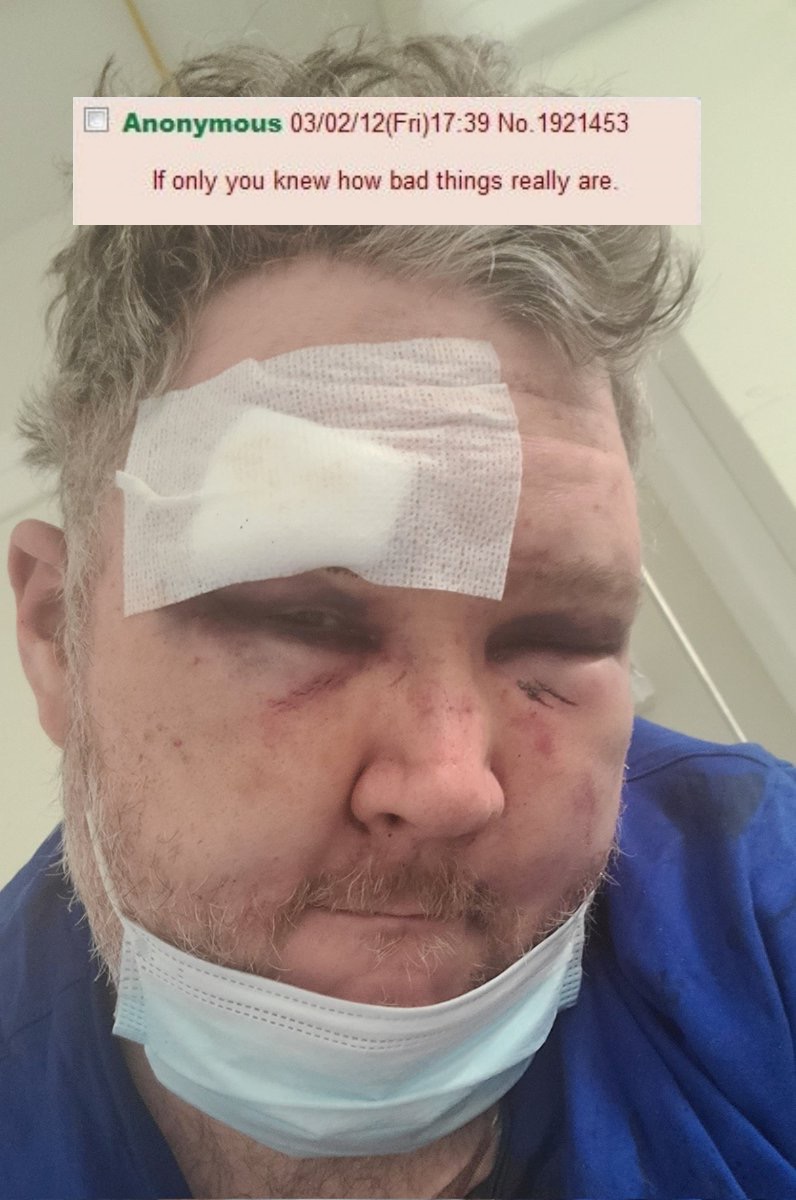 ethan ralph broken.jpg