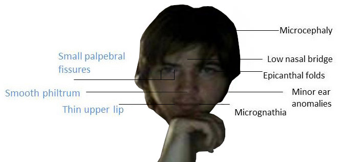 fas_face.jpg