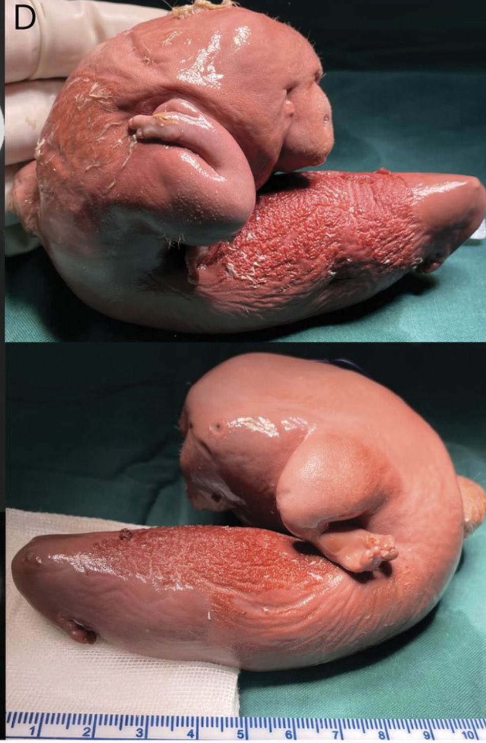 fetus.jpg