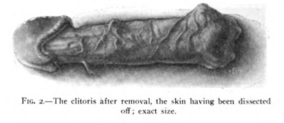 fig2.png