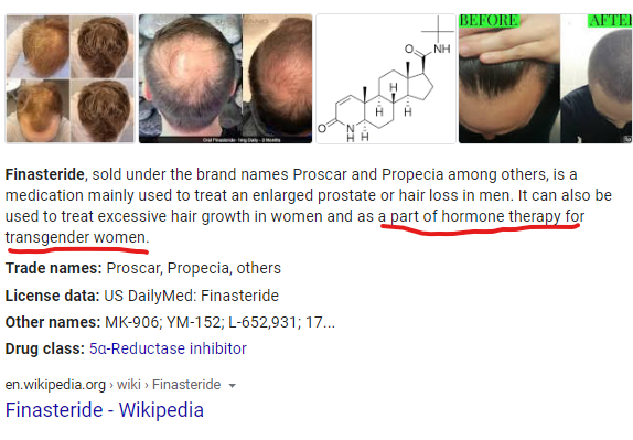 finasteride.png