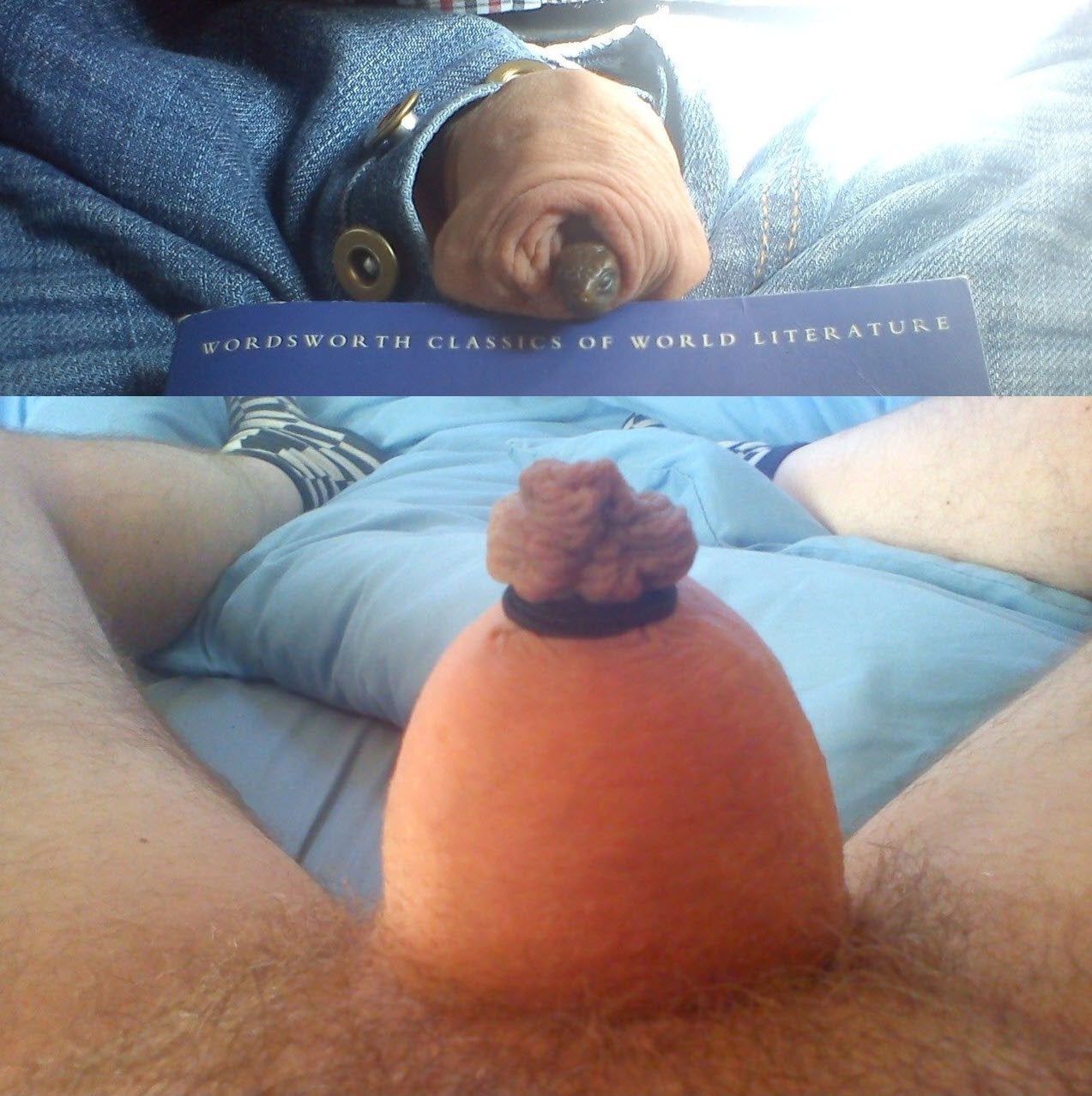 foreskin.jpg