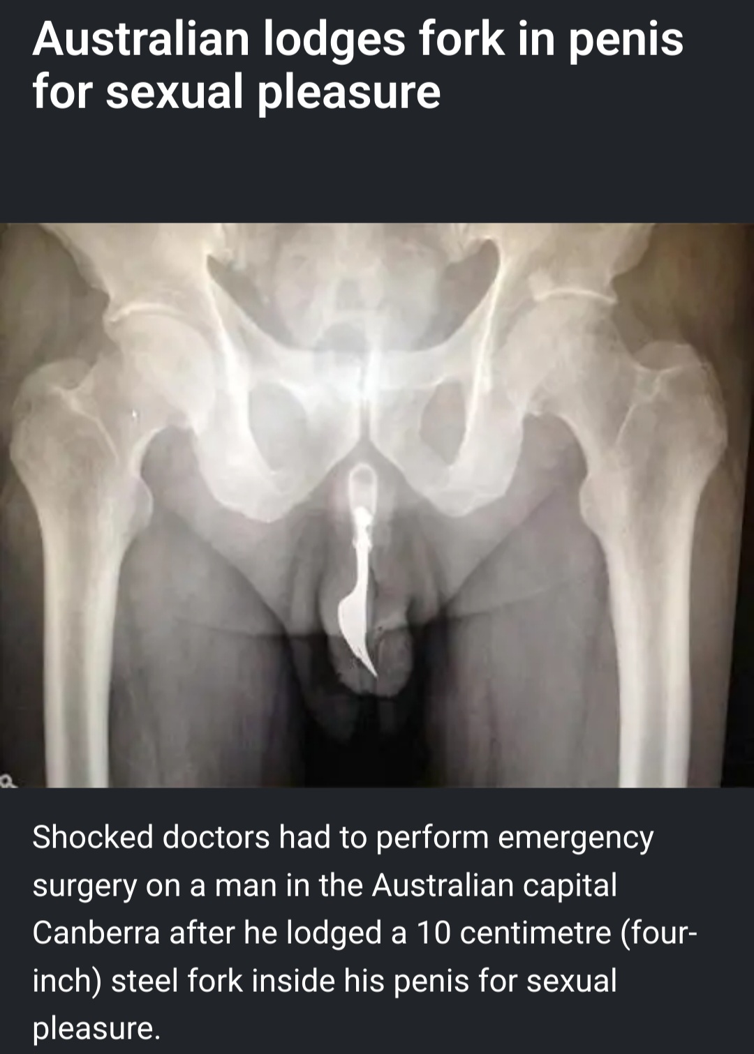 ForkDick.jpg