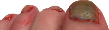 fungus.png