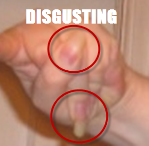 grossnails.png