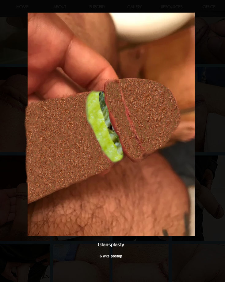 Hairy_fauxphal.jpg