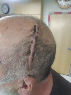 head.jpg