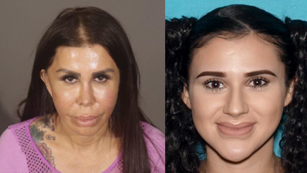 illegal-plastic-surgery.jpg