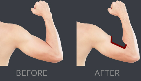 image-removebg-preview.jpg