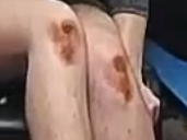 knees.png