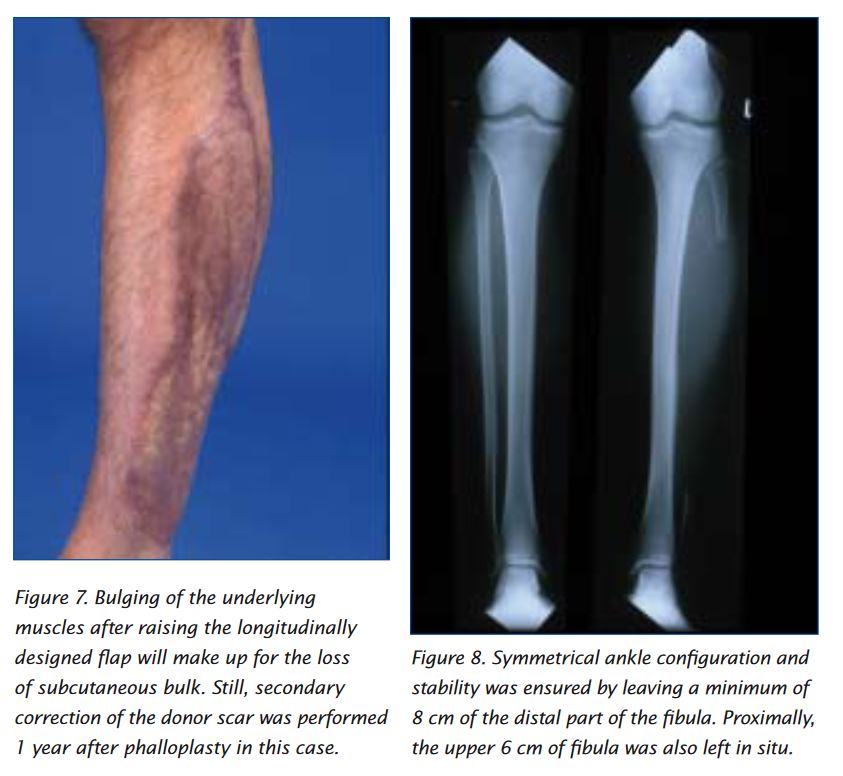 Leg.JPG