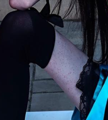 leg2.PNG