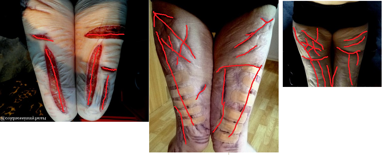legscars.png